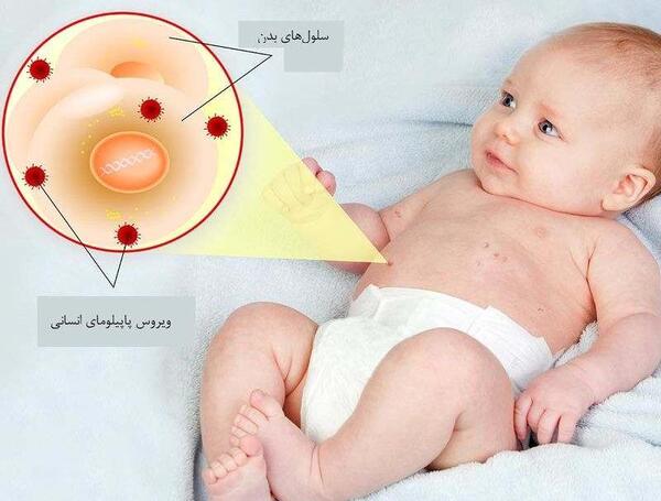 عکس زگیل نی نی سایت