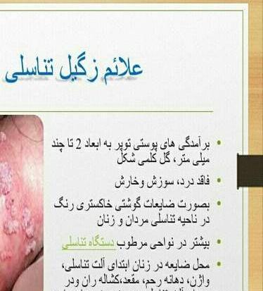 عکس زگیل نی نی سایت
