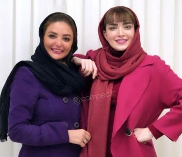 عکس بهنوش طباطبایی قبل از عمل زیبایی