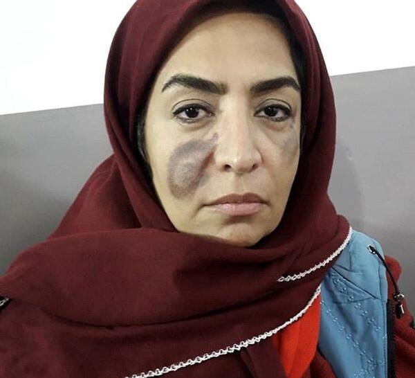 جدیدترین عکس ساناز سماواتی