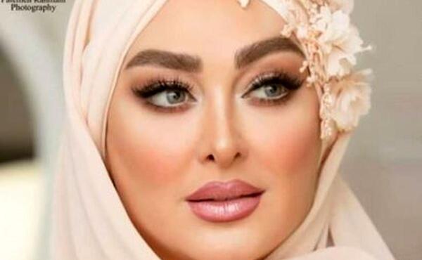 عکس چهره الهام حمیدی
