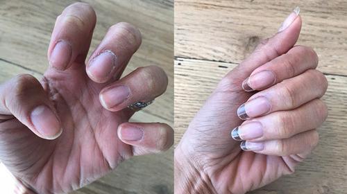 عکس کاشت ژله ای ناخن