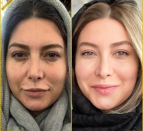 عکس فریبا نادری بعد عمل
