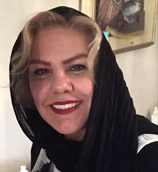عکس افسانه چهره آزاد قبل از عمل