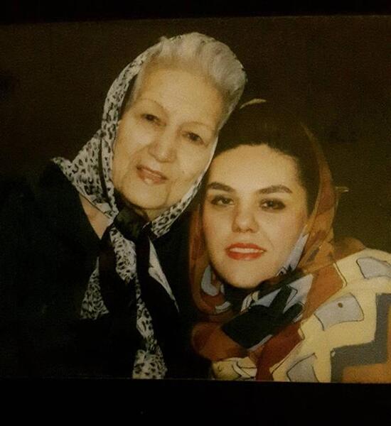 عکس افسانه چهره آزاد قبل از عمل