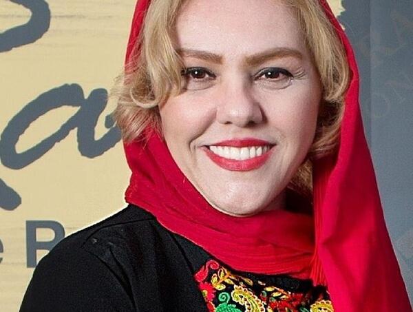 عکس افسانه چهره آزاد قبل از عمل