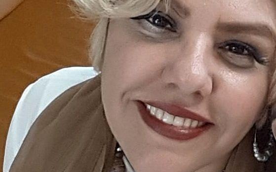 عکس افسانه چهره آزاد قبل از عمل
