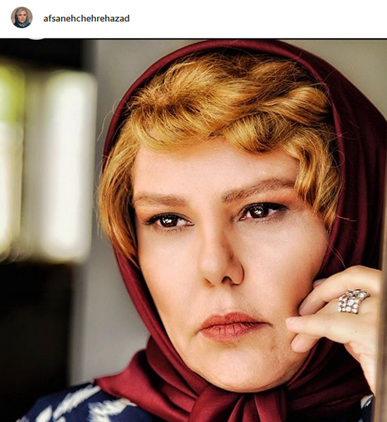 عکس افسانه چهره آزاد قبل از عمل