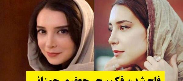 عکس سحر جعفری جوزانی با فک فلج