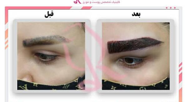 عکس چشم و ابرو طبیعی