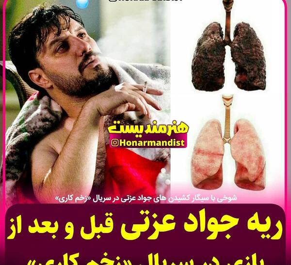 عکس جواد عزتی زخم کاری