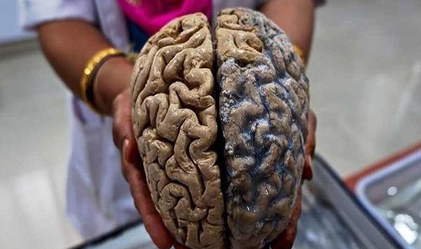 عکس گوزن زامبی