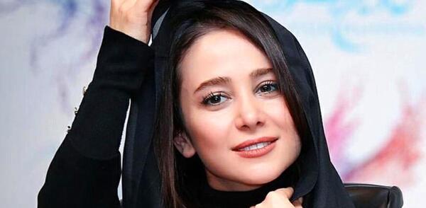 عکس الناز حبیبی قبل از عمل زیبایی