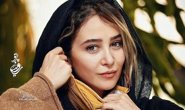 عکس الناز حبیبی قبل از عمل زیبایی