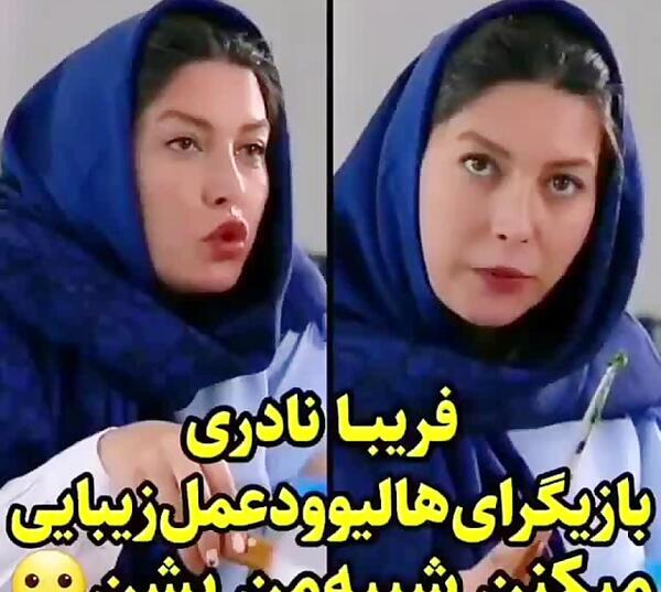 عکس فریبا نادری قبل از جراحی بینی