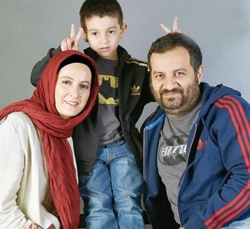 عکس شقایق دهقان قبل و بعد از عمل