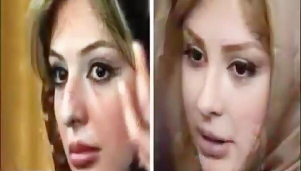 عکس شقایق دهقان قبل و بعد از عمل