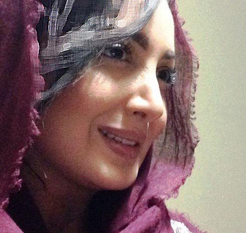عکس شیلا خداداد قبل جراحی بینی