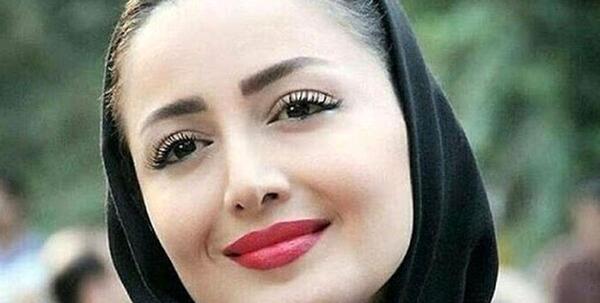 عکس شیلا خداداد قبل جراحی بینی
