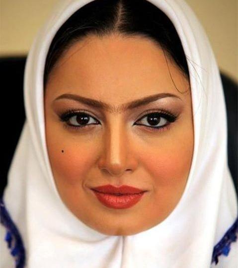 عکس شیلا خداداد قبل جراحی بینی