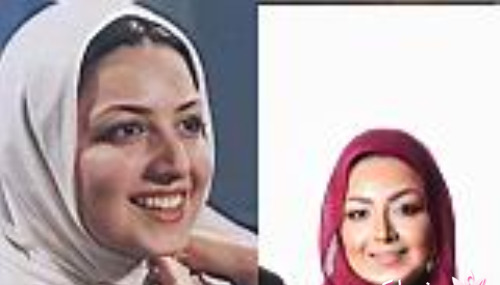 عکس شیلا خداداد قبل جراحی بینی