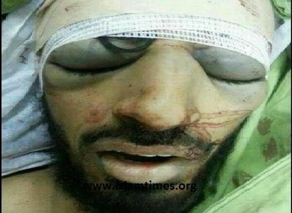 عکس وحشتناک پزشک قانونی