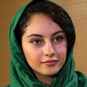 عکس ترلان پروانه بعد از عمل زیبایی