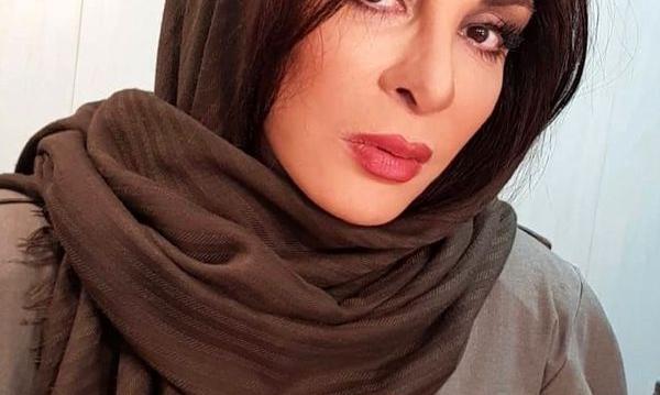 عکس افسانه بایگان بعد از عمل