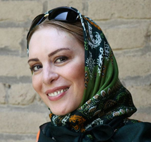 عکس افسانه بایگان بعد از عمل