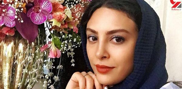 عکس حدیثه تهرانی قبل از عمل بینی