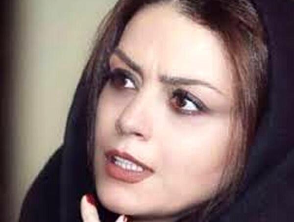 عکس های شبنم فرشادجو قبل از عمل زیبایی