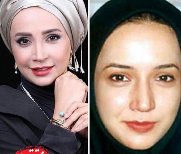 عکس های شبنم فرشادجو قبل از عمل زیبایی