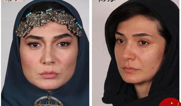 عکس های شبنم فرشادجو قبل از عمل زیبایی