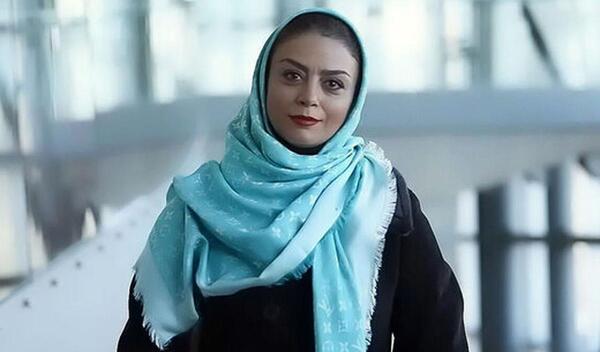 عکس های شبنم فرشادجو قبل از عمل زیبایی