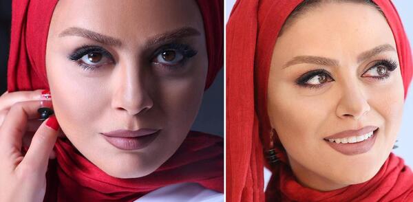 عکس های شبنم فرشادجو قبل از عمل زیبایی
