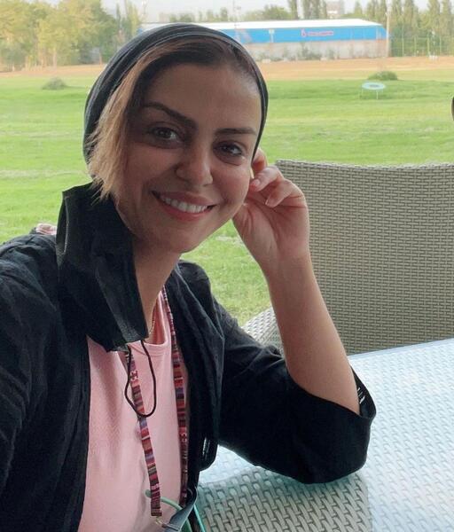 عکس های شبنم فرشادجو قبل از عمل زیبایی
