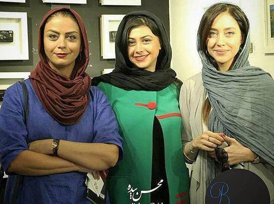 عکس های شبنم فرشادجو قبل از عمل زیبایی