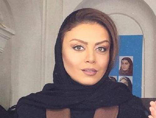 عکس های شبنم فرشادجو قبل از عمل زیبایی