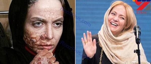 عکس زامبی ایرانی