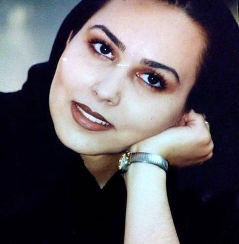 عکس های پرستو صالحی قبل از عمل زیبایی