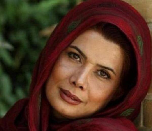 عکس عاطفه رضوی قبل از عمل