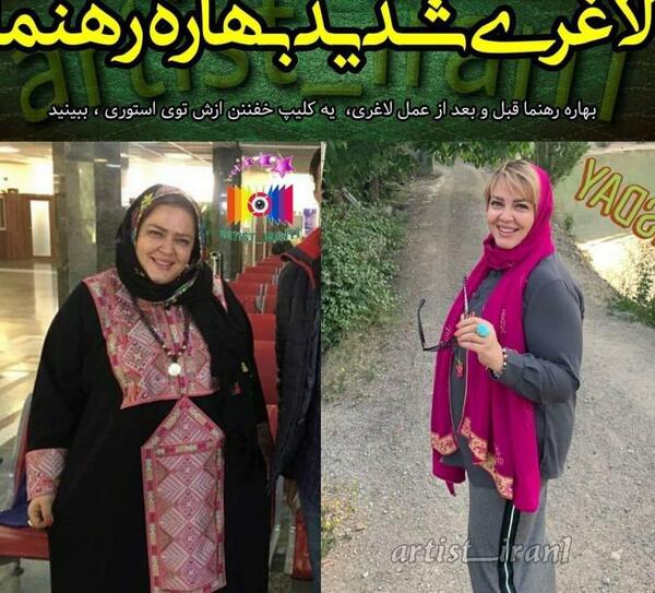 عکس بهاره رهنما قبل از لاغری