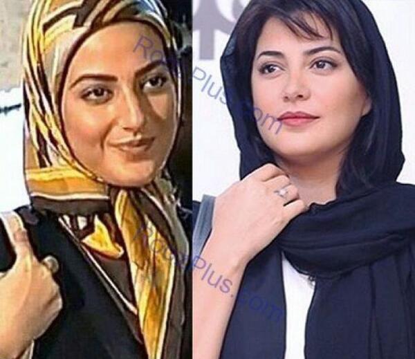 عمل زيبايي عکسهای پریناز ایزدیار قبل از عمل