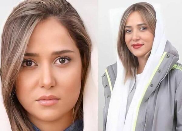 عمل زيبايي عکسهای پریناز ایزدیار قبل از عمل
