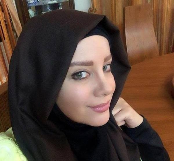 عکسهای شراره رخام بعد از تخلیه لبهایش