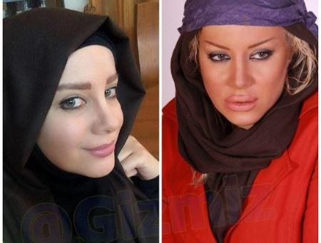 عکسهای شراره رخام بعد از تخلیه لبهایش
