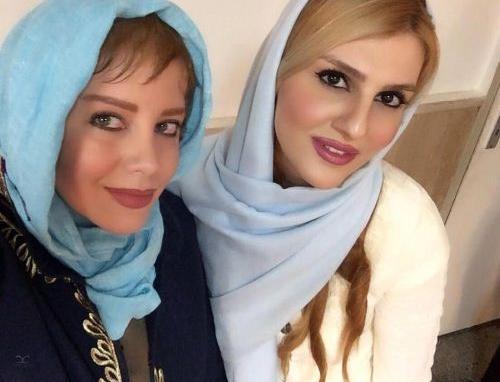 عکسهای شراره رخام بعد از تخلیه لبهایش
