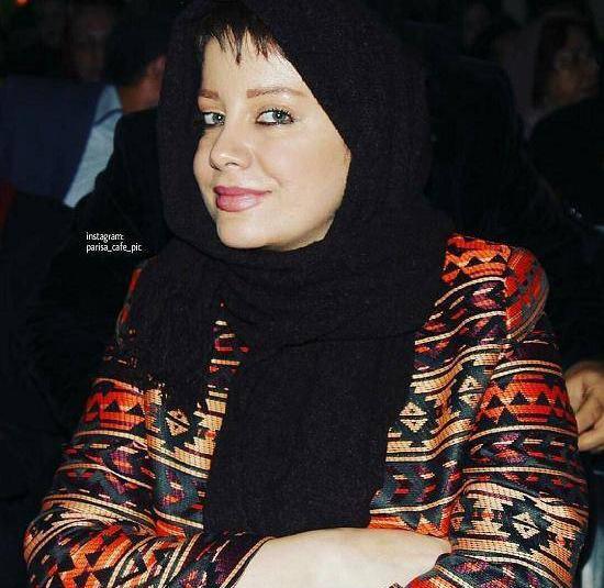 عکسهای شراره رخام بعد از تخلیه لبهایش