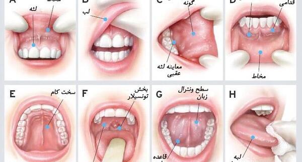 عکس داخل دهان انسان
