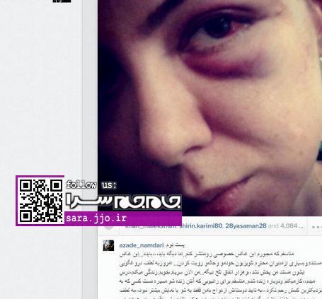 عکس العمل فرزاد حسنی با مرگ آزاده نامداری